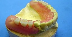 Зубні протези